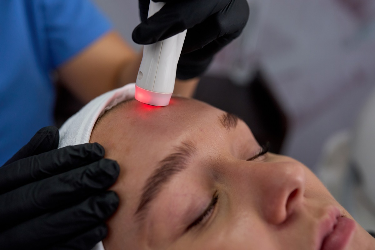 A student receives and IPL treatment L4 Aesthetics